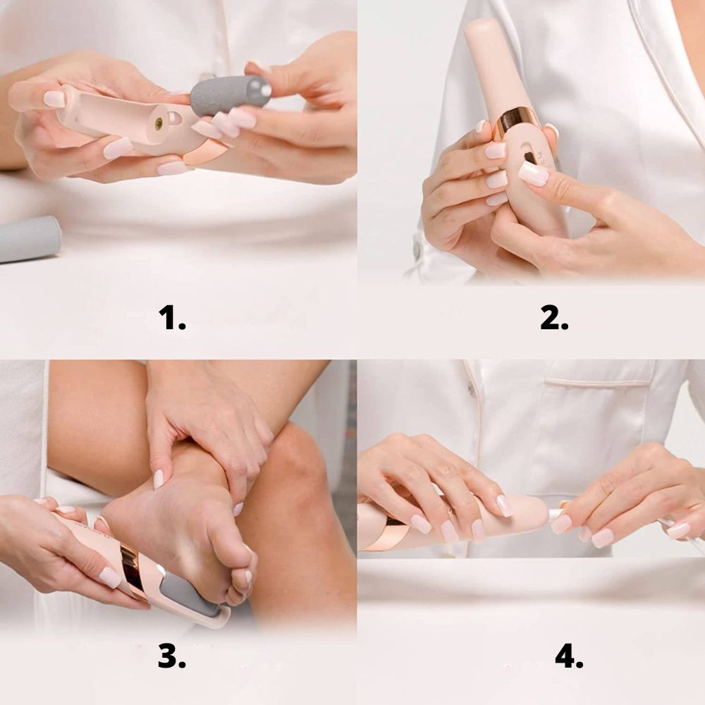 dry skin remover peta slika